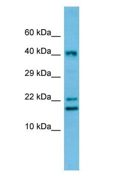 Polyclonal Rabbit anti-Rat CREM / ICER Antibody (C-Terminus, IHC, WB)