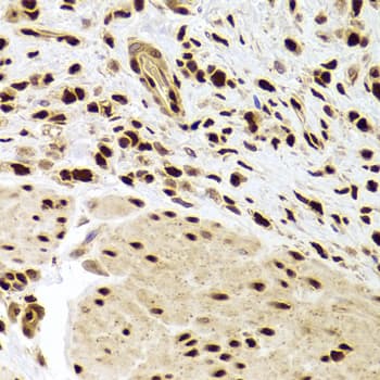 PHAP1 / ANP32A Antibody
