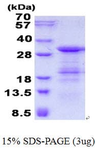 Human GINS4 / SLD5 Protein (Recombinant His)