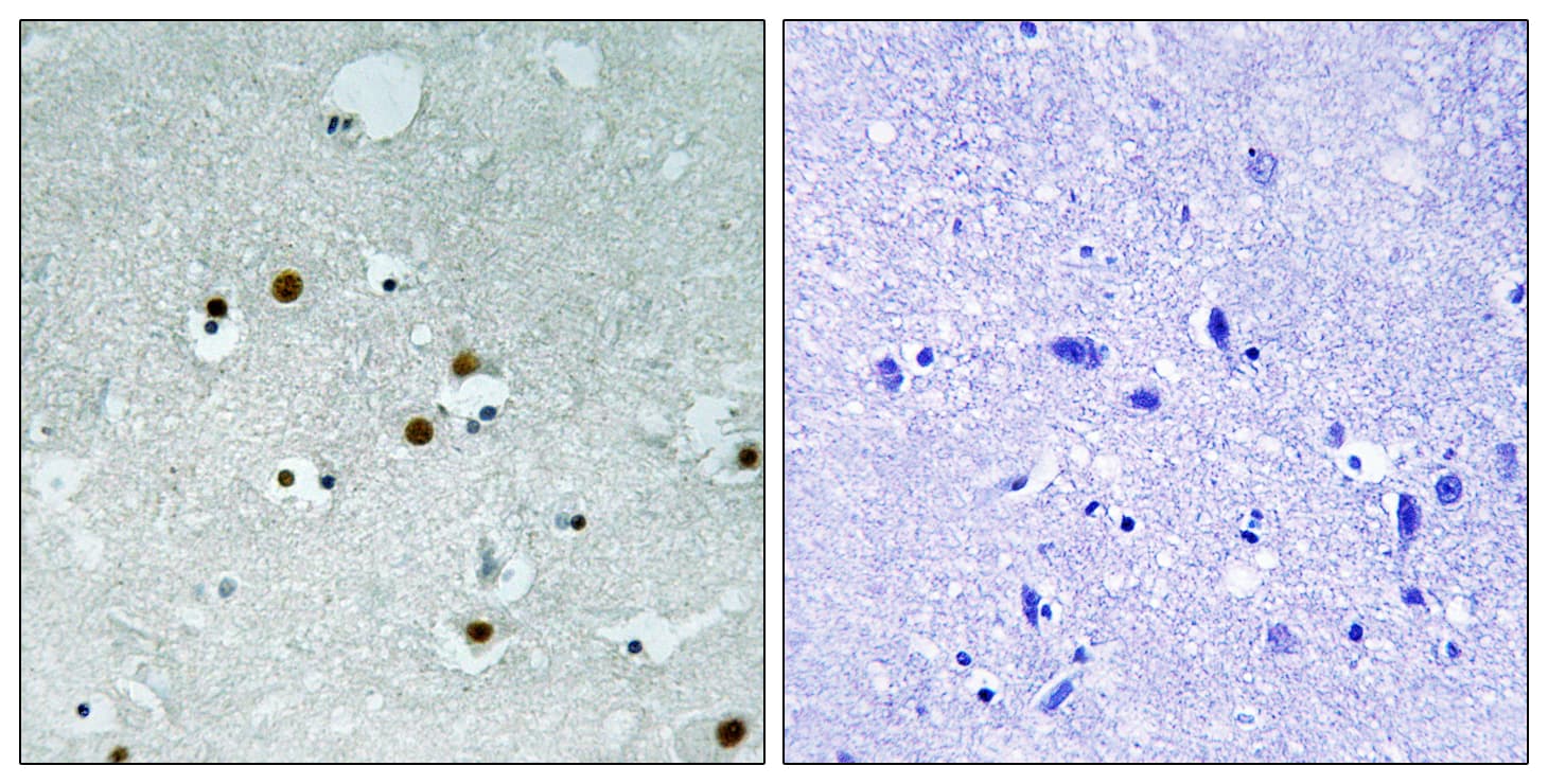 CBX5 / HP1 Alpha Antibody (aa58-107)
