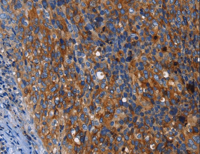 MSLN / Mesothelin Antibody