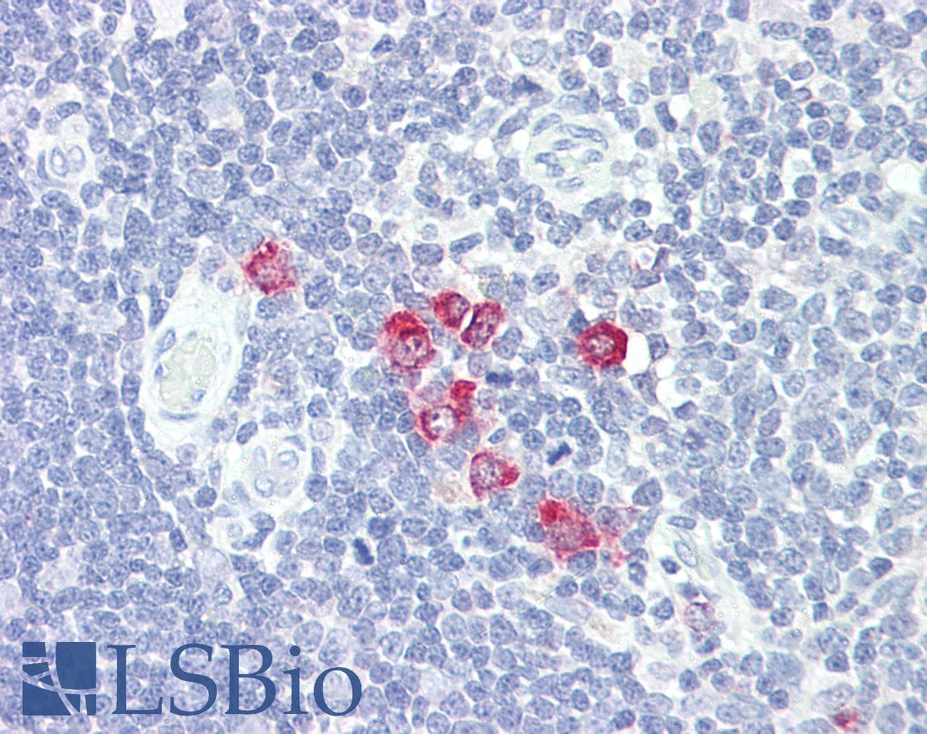 Polyclonal Rabbit anti-Human CHST4 / GlcNAc6ST2 Antibody (aa234-283, IHC, WB)