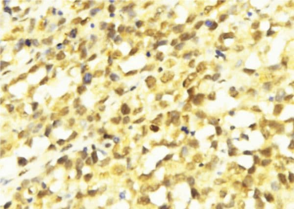 SMARCAD1 Antibody