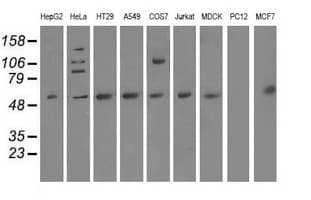 NT5DC1 Antibody (clone OTI3A6)