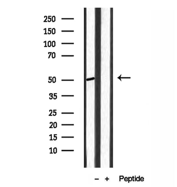 IHC-plus™ Polyclonal Rabbit anti-Human ACOX1 / ACOX Antibody (IHC, WB)