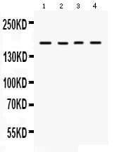 HKDC1 Antibody (aa102-136)