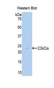 CPT1A Antibody (aa191-353)