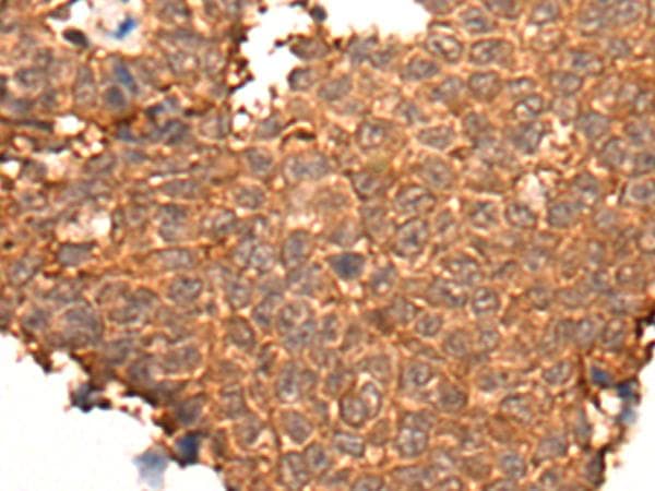 Polyclonal Rabbit anti-Human HOXD8 Antibody (IHC)