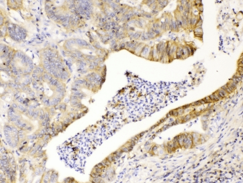 Polyclonal Rabbit anti-Human Basigin / Emmprin / CD147 Antibody (IHC, WB)