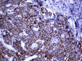 PIK3CD / PI3K Delta Antibody (aa286-610, clone OTI2D9)