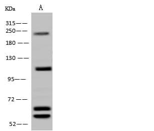 AARS2 Antibody