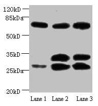 APP / Beta Amyloid Precursor Antibody (clone 5A11E5)