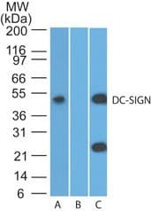 Polyclonal Rabbit anti-Human CD209 / DC-SIGN Antibody (aa320-370, WB)