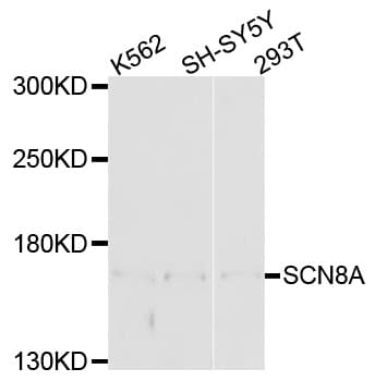 SCN8A / Nav1.6 Antibody