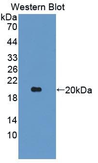 ANGPTL2 / ARP2 Antibody (aa47-207, PE)