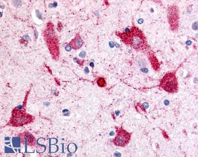 PathPlus™ VRL1 / TRPV2 Antibody (N-Terminus)