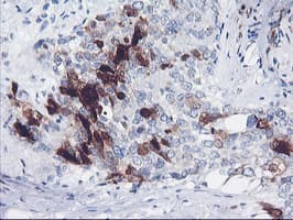 SERPINB2 / PAI-2 Antibody (clone OTI1E3, Carrier-free)