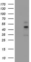 Monoclonal Mouse anti-Human CPA1 / Carboxypeptidase A Antibody (clone OTI1C1, IF, WB)