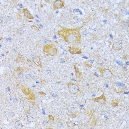 ACADSB Antibody