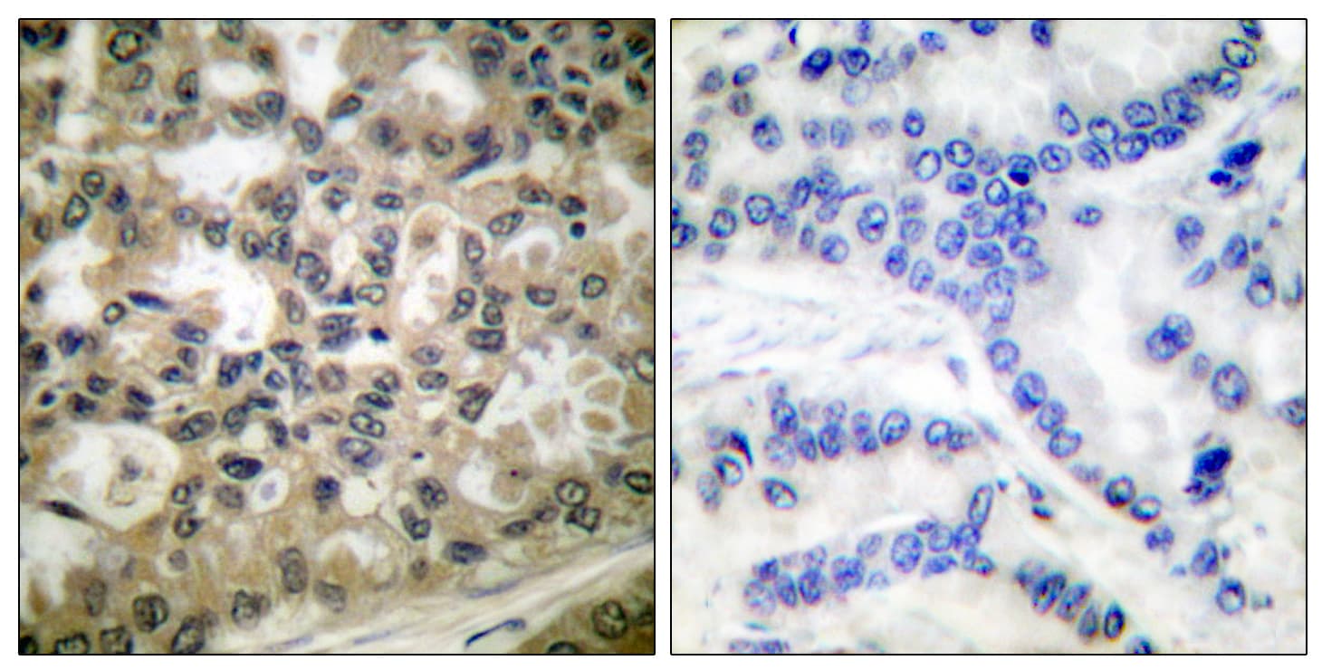 NFKBIB / IKB Beta / IKBB Antibody (phospho-Ser23)