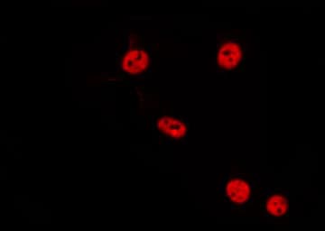 Polyclonal Rabbit anti-Human PPP2R3B Antibody (IF, WB)