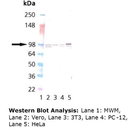 IHC-plus™ CANX / Calnexin Antibody