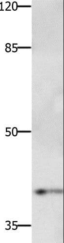 PTGER1 / EP1 Antibody