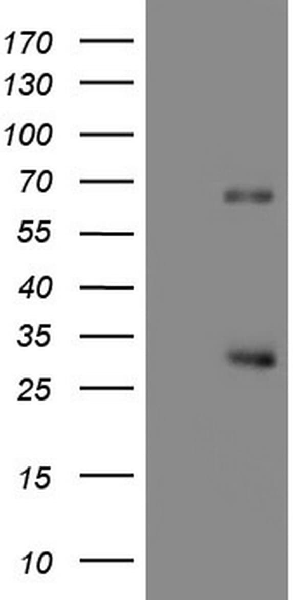 Monoclonal Mouse anti-Human CFLAR / FLIP Antibody (clone OTI1B1, aa1-272, WB)