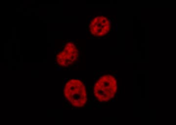 CSNK1E / CK1 Epsilon Antibody