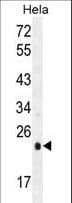 IHC-plus™ UQCRFS1 Antibody (aa181-209)