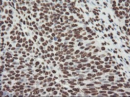 FBXO21 Antibody (clone OTI6E7, Carrier-free)
