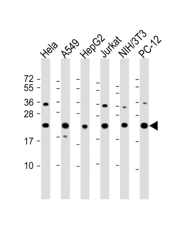 RPS7 / Ribosomal Protein S7 Antibody (C-Terminus)