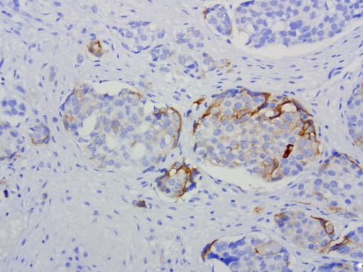 L1CAM Antibody (clone UMAB47)