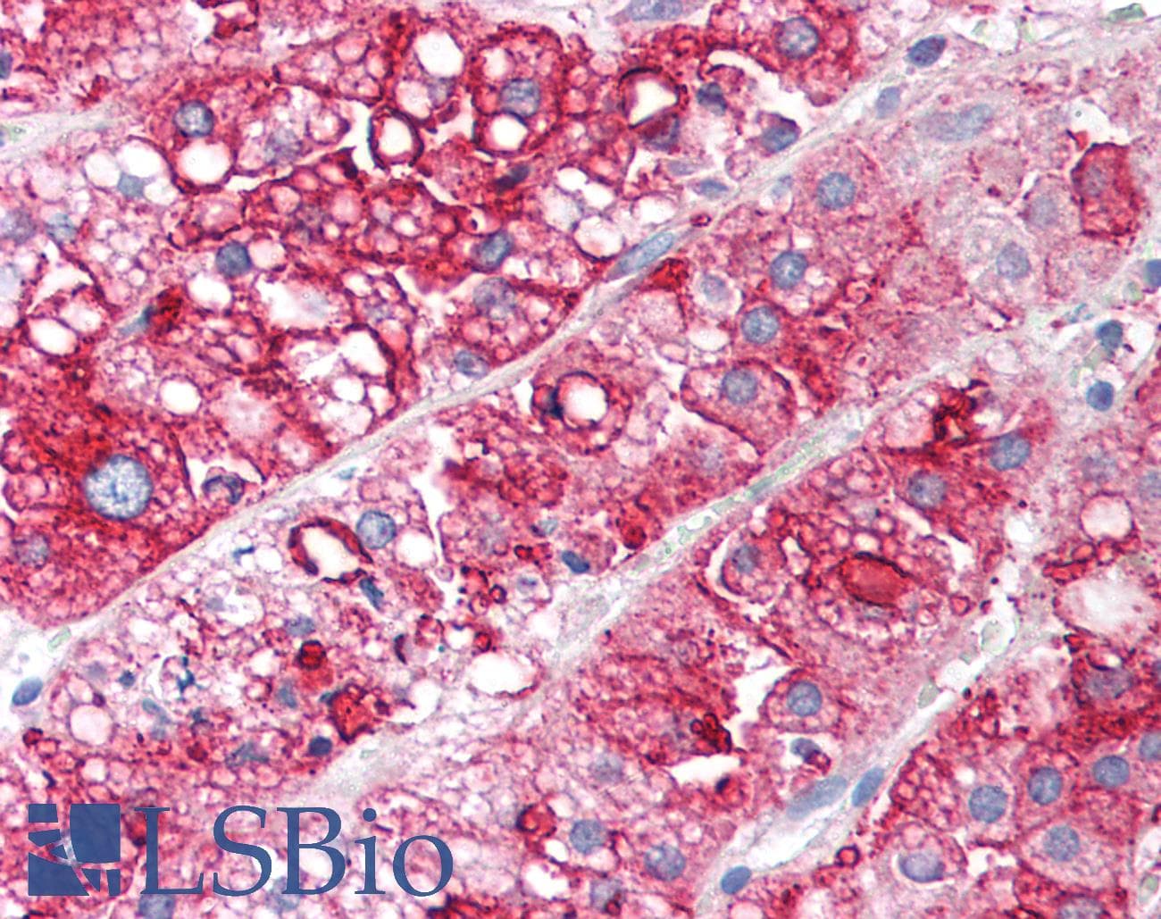 SCARB1 / SR-BI Antibody (Biotin)