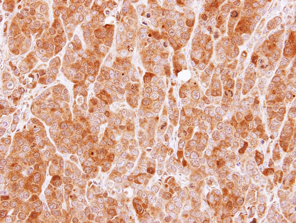 MVD Antibody (aa156-371)