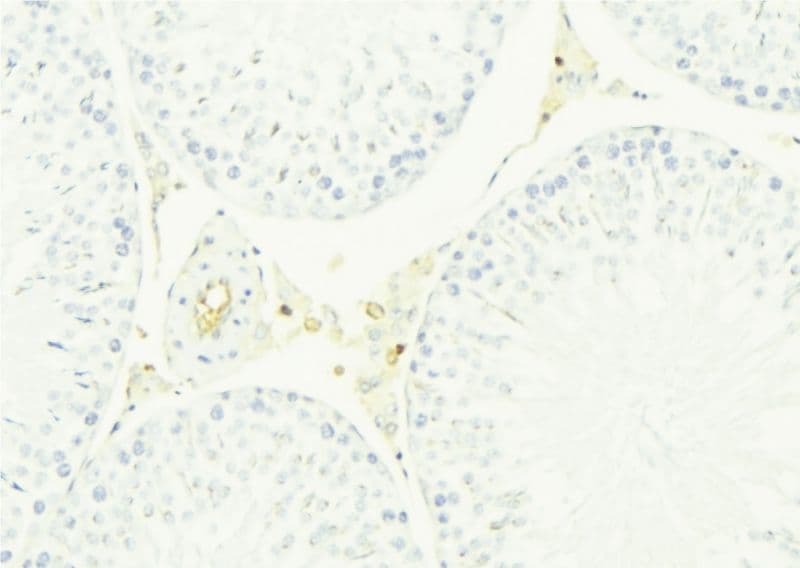 CST8 / CRES Antibody