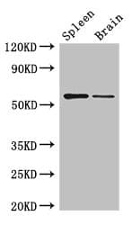 Polyclonal Rabbit anti-Human D2HGDH Antibody