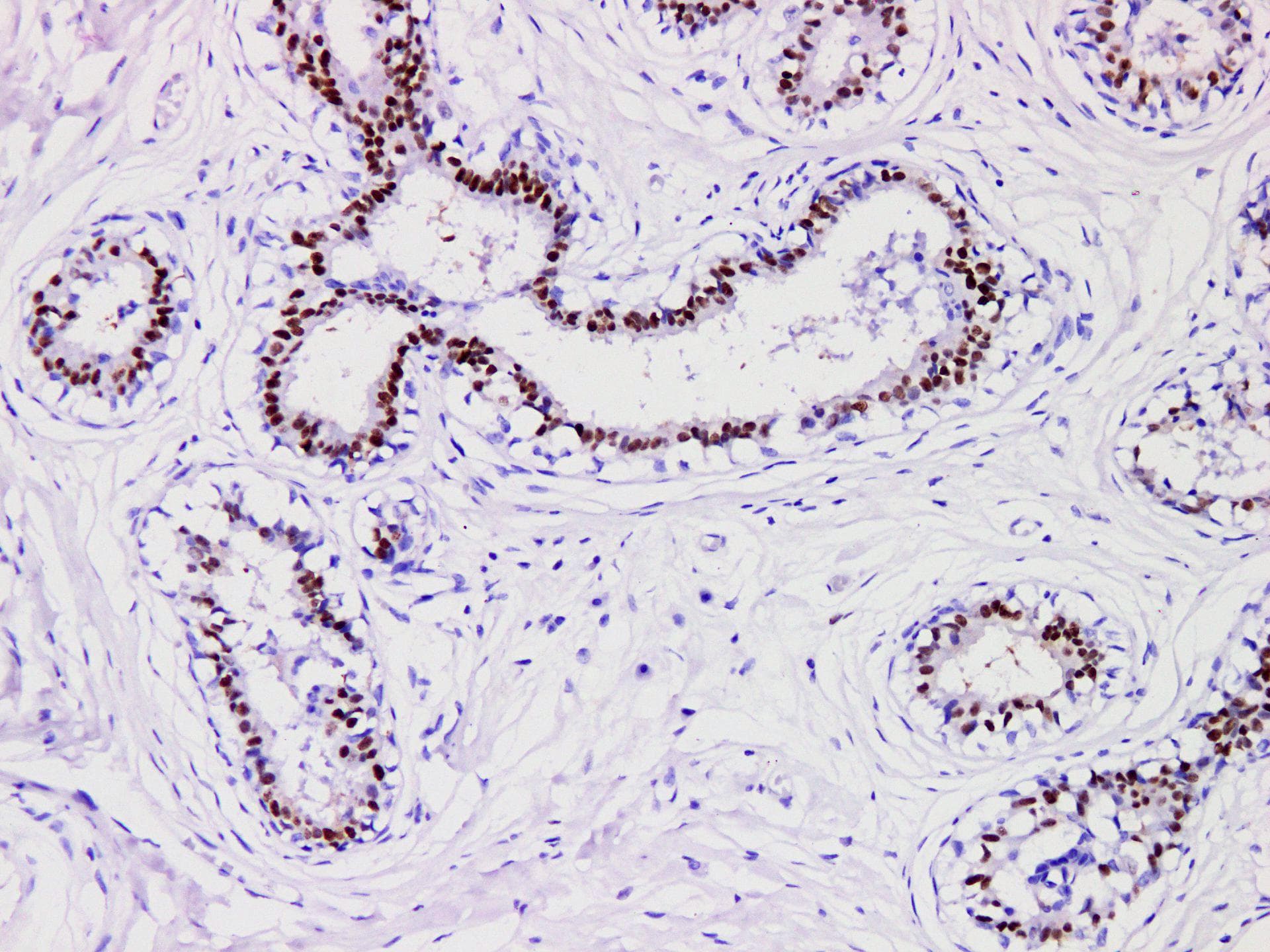 PR / Progesterone Receptor Antibody