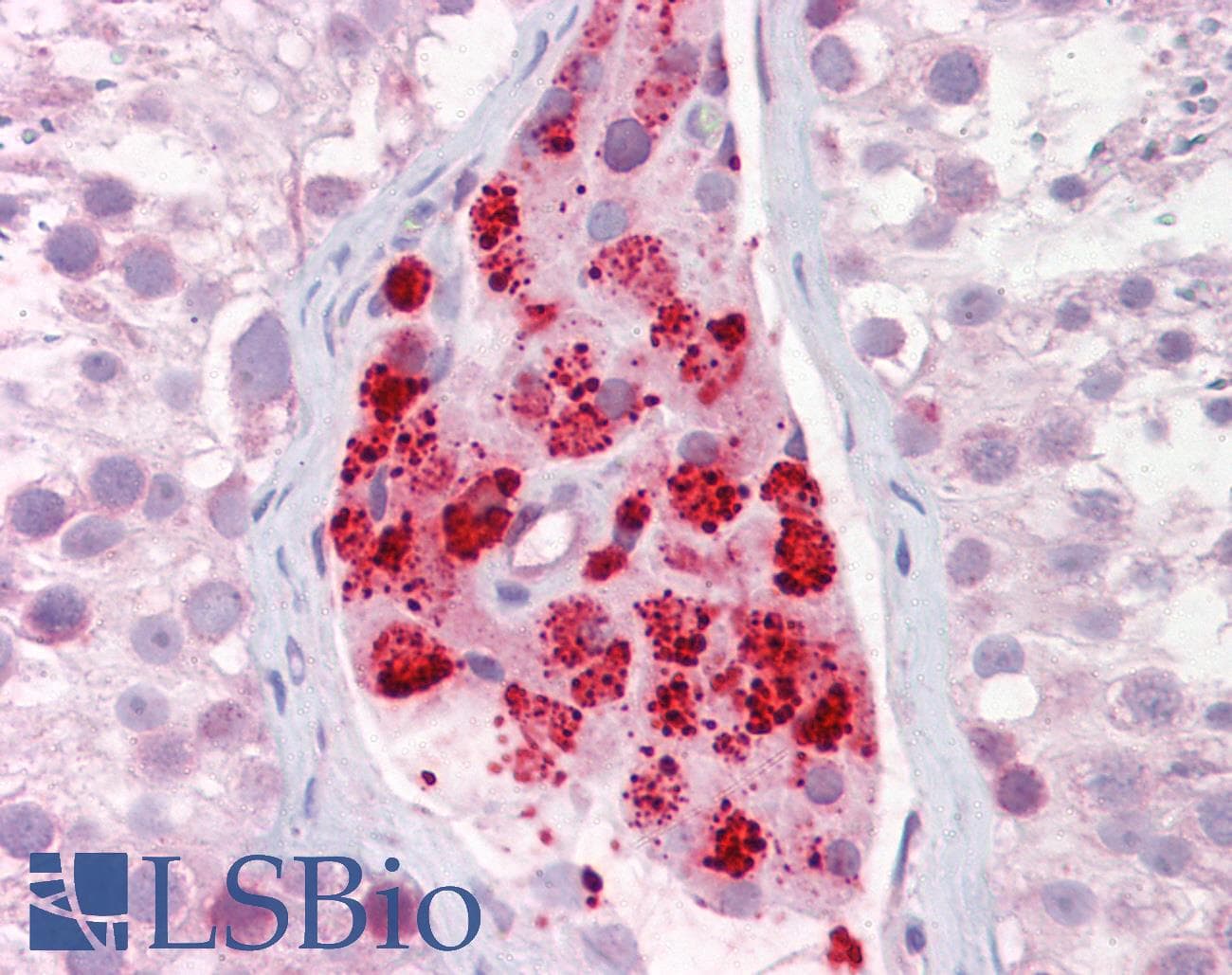 IHC-plus™ Polyclonal Rabbit anti-Human AURKA / Aurora-A Antibody (aa100-150, IHC, WB)
