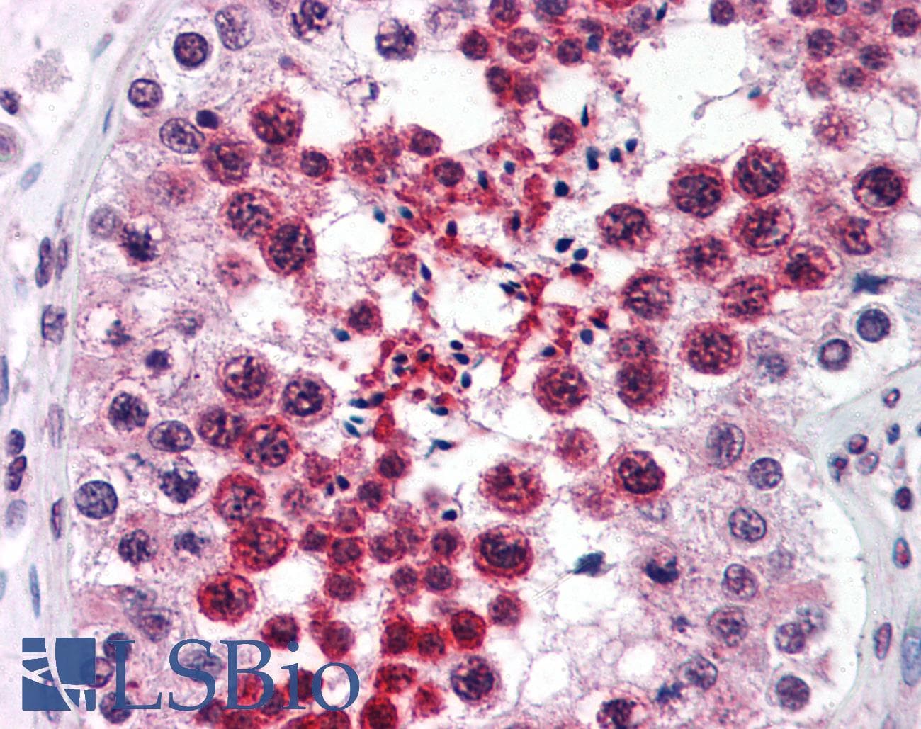 IHC-plus™ RTN4 / Nogo Antibody