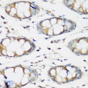BMP2 Antibody