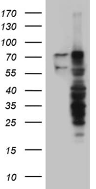 Monoclonal Mouse anti-Human RLIM / RNF12 Antibody (clone OTI2D7, Carrier-free, IHC, WB)
