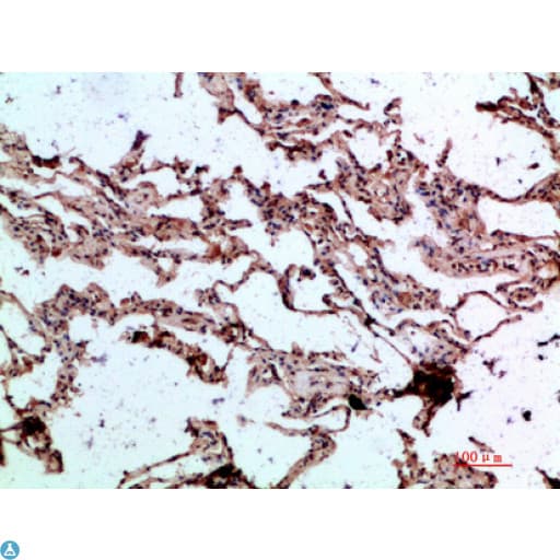 GDF2 / BMP9 Antibody
