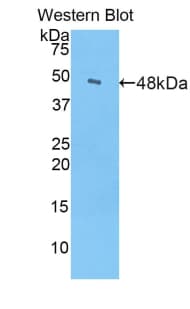 Alpha-Fetoprotein Antibody (aa381-567, Cy3)