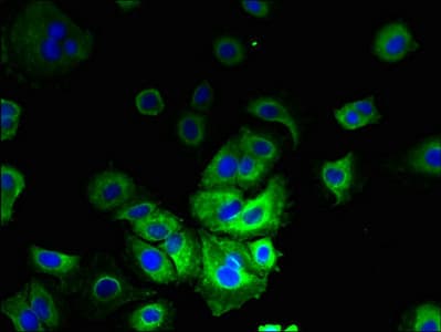 TMEM153 / LMF2 Antibody