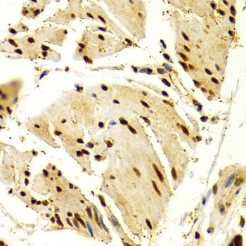 NFATC1 / NFAT2 Antibody