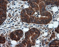 TPMT Antibody (clone OTI2A2)