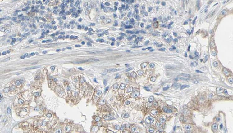 GNB2 Antibody