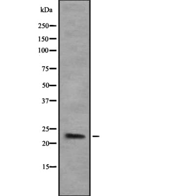 COPS8 / COP9 Antibody