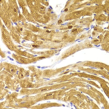 Polyclonal Rabbit anti-Human CSRP3 Antibody (IHC, IF, WB)